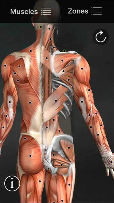 Muscle Trigger Point Anatomy screenshot
