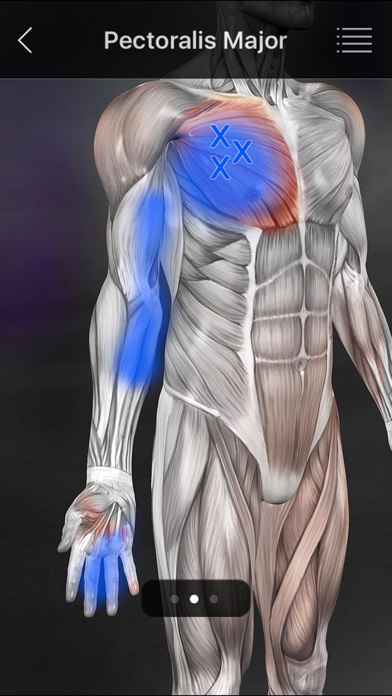 Muscle Trigger Point Anatomy screenshot